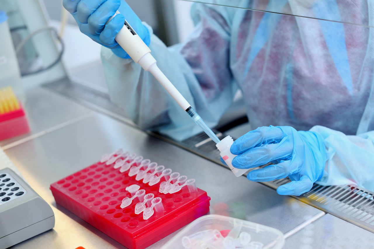 The journey of my dog’s sample in the genetic lab. Step 1